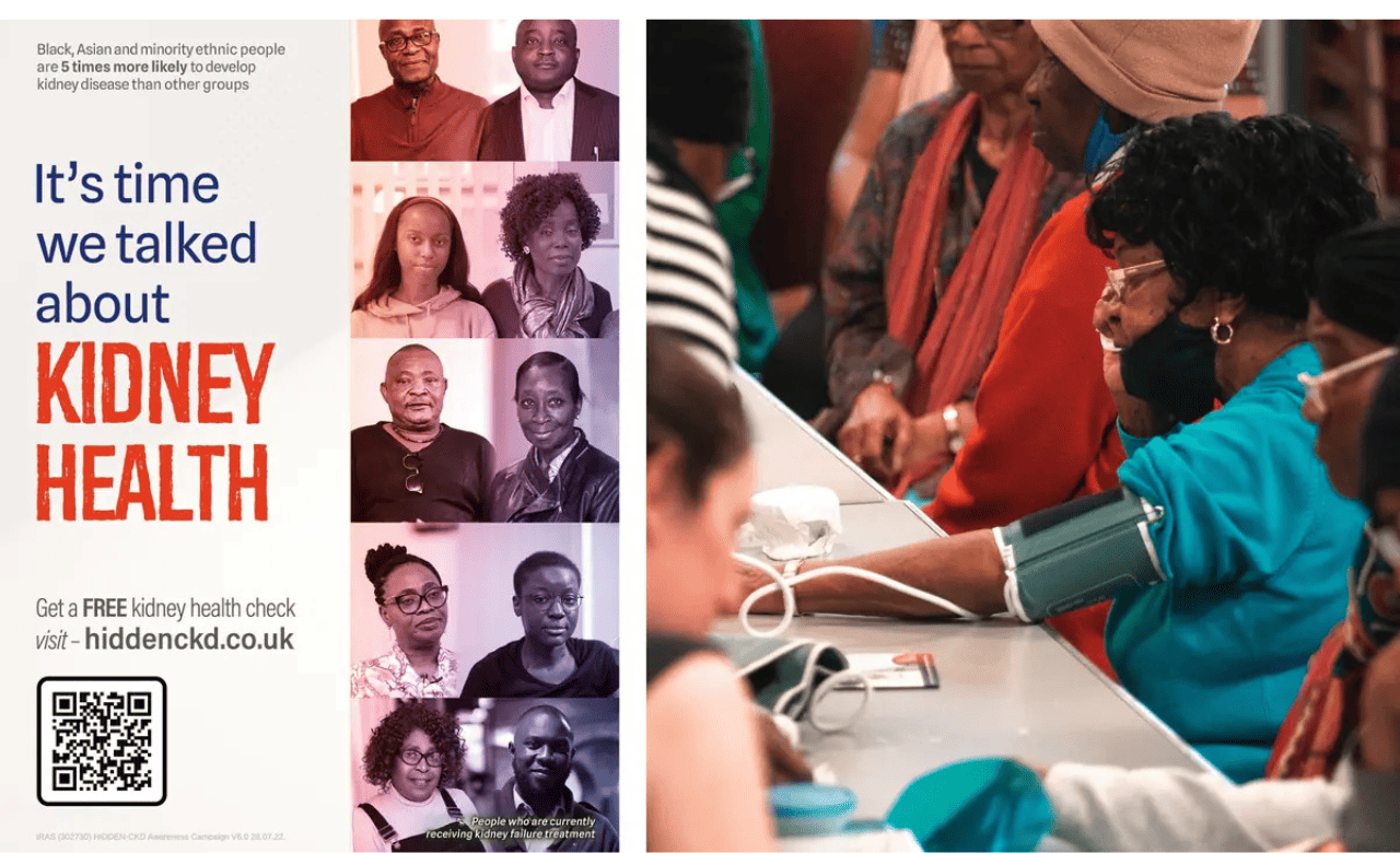 Kings College London — Chronic Kidney Disease Project